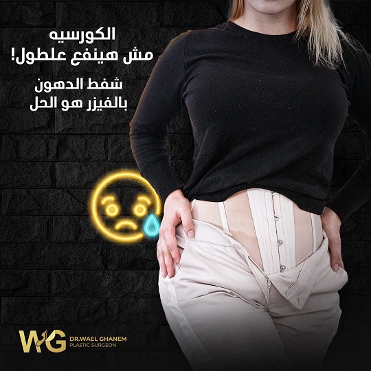 شفط الدهون بالفيزر