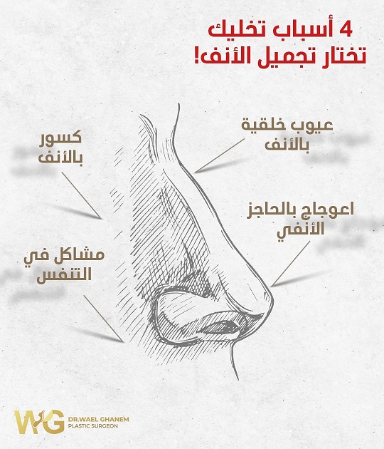 أسباب تجميل الأنف