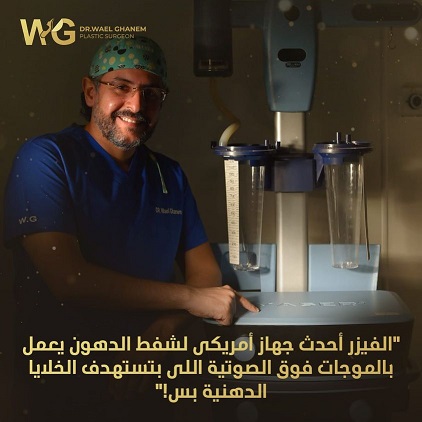 شفط الدهون