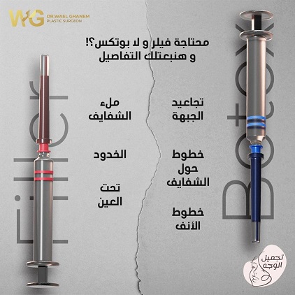 فيلر