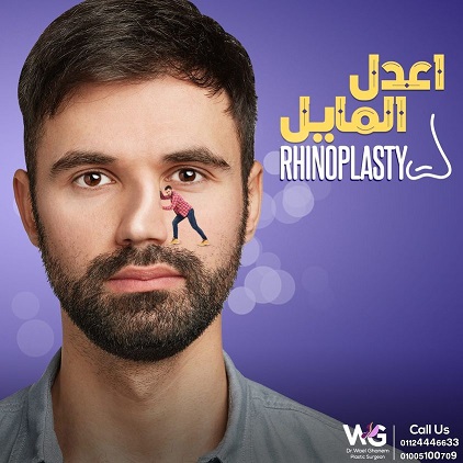 تجميل الأنف