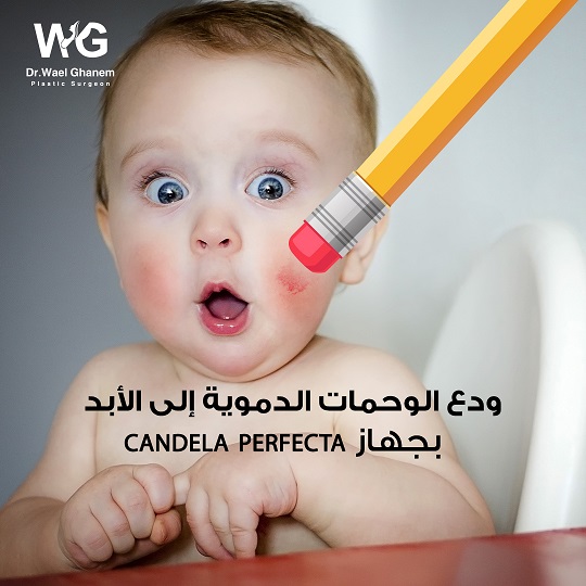 وحمات
