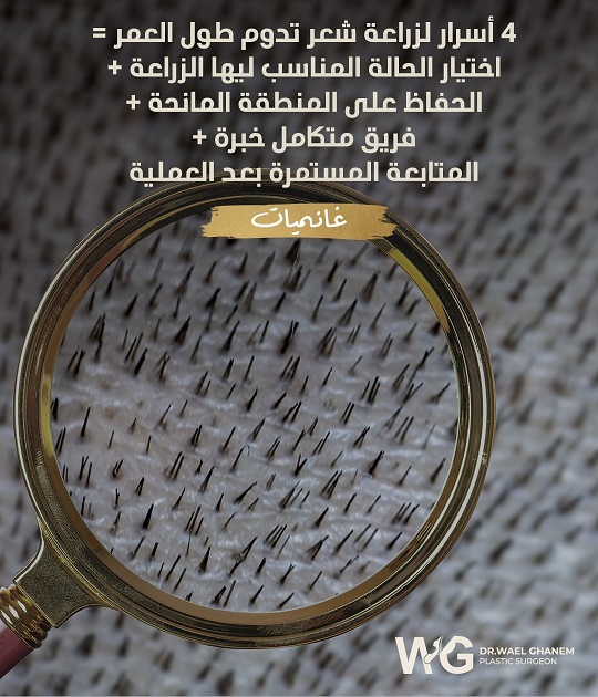 زراعة الشعر